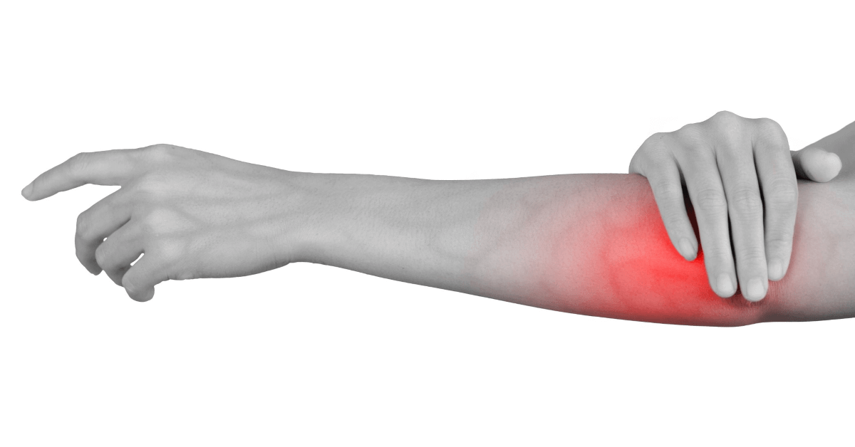 Ulnar Nerve Entrapment, What Is It?